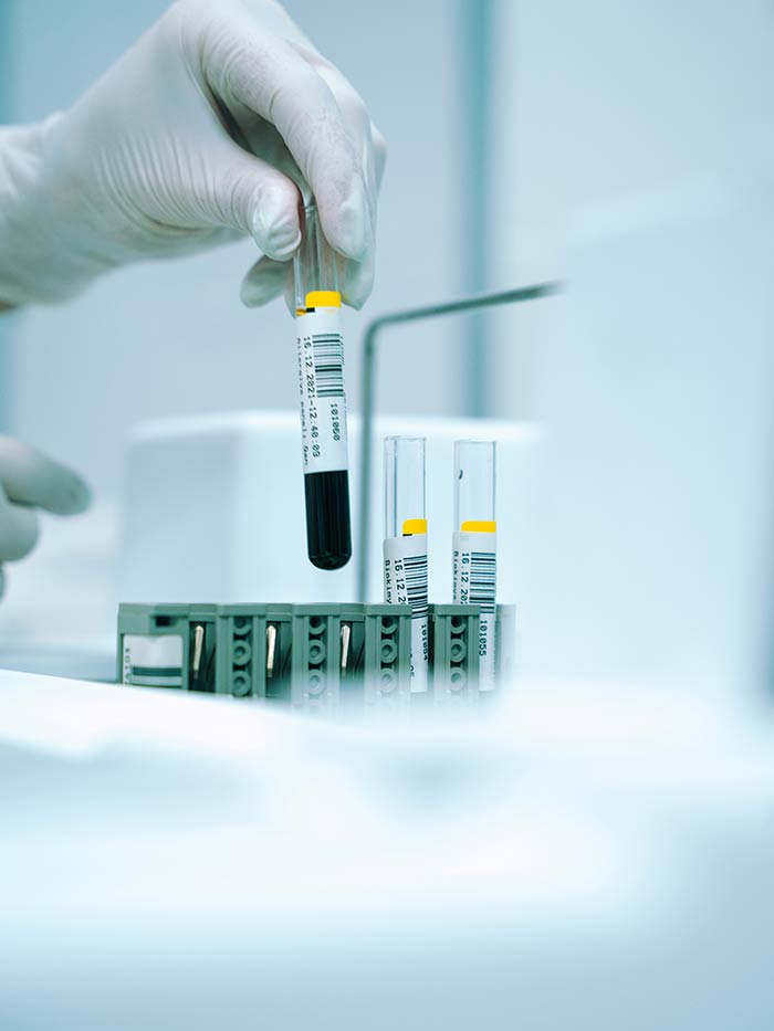 Laboratoire d'analyse biologique mobile (urgence, groupe), Lyon, Rhône-Alpes